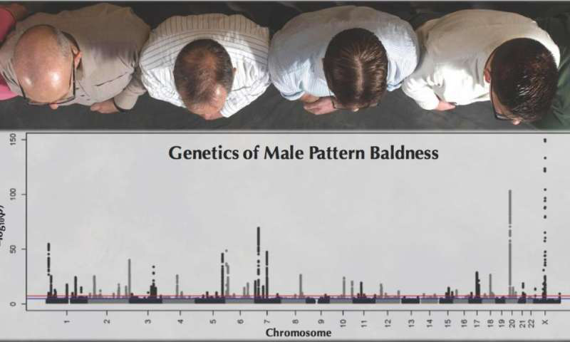 最新的研究结果帮助我们预测男性脱发 ​